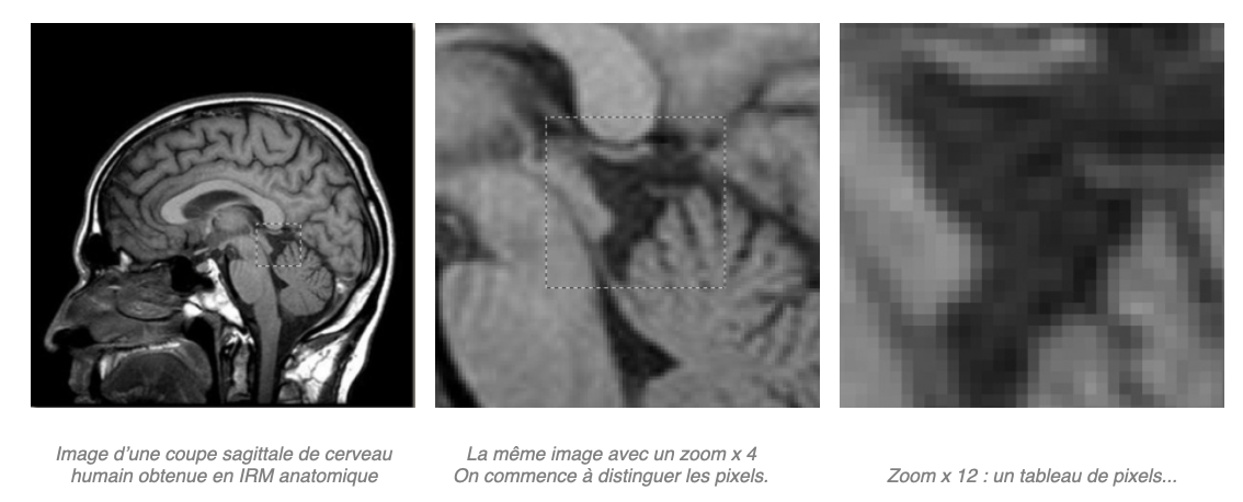 agrandissement jusqu'à pixelisation